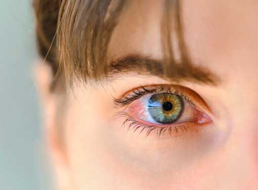 Evil Eye Treatment And Protection
