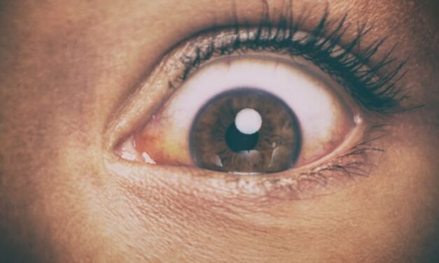 Nazar Lagne Ki Alamat In Urdu